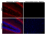 MAP2 Antibody in Immunohistochemistry (Paraffin) (IHC (P))
