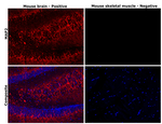 MAP2 Antibody in Immunohistochemistry (Paraffin) (IHC (P))