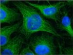 beta Tubulin Antibody in Immunocytochemistry (ICC/IF)