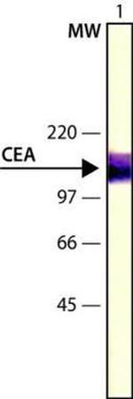 CEA Antibody in Western Blot (WB)