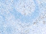 IRF4 Monoclonal Antibody (MUM1p)