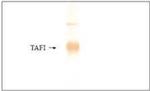 Carboxypeptidase B2 Antibody in Western Blot (WB)