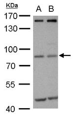 MDM2 Antibody in Western Blot (WB)