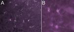 HLA-DR/DP/DQ Antibody in Immunohistochemistry (IHC)