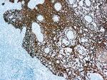 Cytokeratin 5/6/8/17/10 Antibody in Immunohistochemistry (Paraffin) (IHC (P))