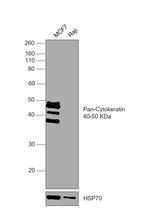Cytokeratin 5/6/8/17/10 Antibody in Western Blot (WB)