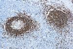 Hairy Cell Leukemia Antibody in Immunohistochemistry (Paraffin) (IHC (P))