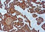 Cytokeratin Pan Type II Monoclonal Antibody (AE3)