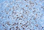 CD30 Monoclonal Antibody (Ber-H2)