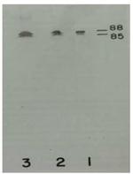 Plasma Kallikrein Monoclonal Antibody (13G11)