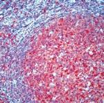 Caspase 3 Antibody in Immunohistochemistry (IHC)