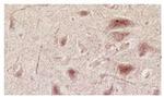 NMDAR3A/NMDAR3B Monoclonal Antibody (K35/40)