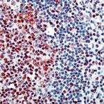 E2F4 Antibody in Immunohistochemistry (IHC)