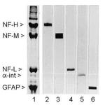 NEFM Antibody in Western Blot (WB)