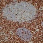 CD43 Antibody in Immunohistochemistry (Paraffin) (IHC (P))