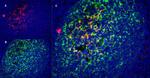 CD21 Antibody in Immunohistochemistry (Frozen) (IHC (F))