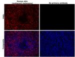 PMEL Antibody in Immunohistochemistry (Paraffin) (IHC (P))