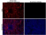 PMEL Antibody in Immunohistochemistry (Paraffin) (IHC (P))