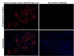 Progesterone Receptor Monoclonal Antibody (PR-AT 4.14)