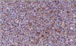 NOXA Antibody in Immunohistochemistry (Paraffin) (IHC (P))