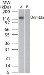DNMT3A Antibody in Western Blot (WB)