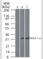 ROCK1 (Cleaved Asp1113) Monoclonal Antibody (154C1465)