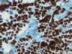 Myogenin Antibody in Immunohistochemistry (Frozen) (IHC (F))