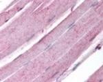 Myogenin Antibody in Immunohistochemistry (Paraffin) (IHC (P))