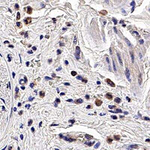 PGRP-S Monoclonal Antibody (188C424)