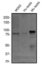 RANK Antibody in Western Blot (WB)