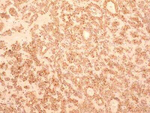 TEM8 Monoclonal Antibody (200C1339 (SB20))