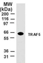 TRAF5 Monoclonal Antibody (55A219)