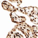 MBD3 Antibody in Immunohistochemistry (Paraffin) (IHC (P))
