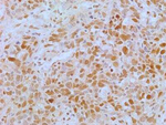 APIP Antibody in Immunohistochemistry (Paraffin) (IHC (P))