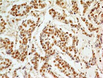 APIP Monoclonal Antibody (19F461)