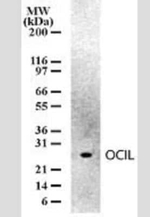 CLEC2D Monoclonal Antibody (166C1309)