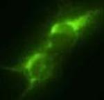 GLT-1 Antibody in Immunocytochemistry (ICC/IF)