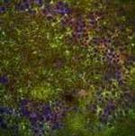 GLT-1 Antibody in Immunohistochemistry (IHC)