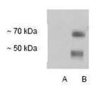 GLT-1 Antibody in Western Blot (WB)