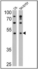 DRD5 Antibody in Western Blot (WB)