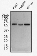 WT1 Antibody in Western Blot (WB)