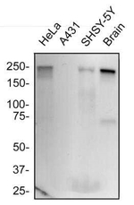 CD171 Antibody in Western Blot (WB)