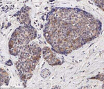 EpCAM Antibody in Immunohistochemistry (Paraffin) (IHC (P))