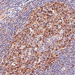 LMO2 Monoclonal Antibody (1A9-3B11)