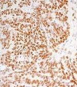 NAC1 Antibody in Immunohistochemistry (IHC)