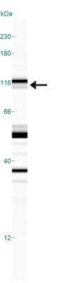 Phospho-NHE3 (Ser522) Monoclonal Antibody (14D5)