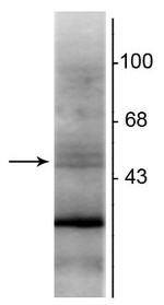 RXRB Monoclonal Antibody (147)