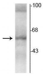 THRA Monoclonal Antibody (1330)