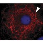 Cytokeratin 3 Monoclonal Antibody (AE5)