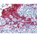 Cytokeratin 13 Monoclonal Antibody (AE8)